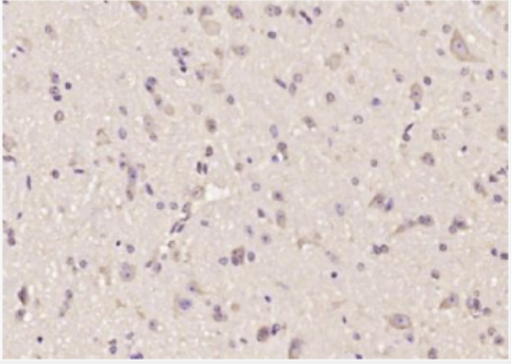 Anti-AOC1 antibody-阿米洛利结合蛋白1抗体