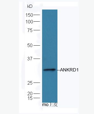 Anti-ANKRD1 antibody-心肌锚蛋白重复结构域1抗体