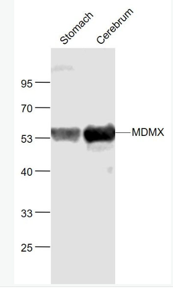 Anti-MDMX antibody-MDM2样P53蛋白结合抗体