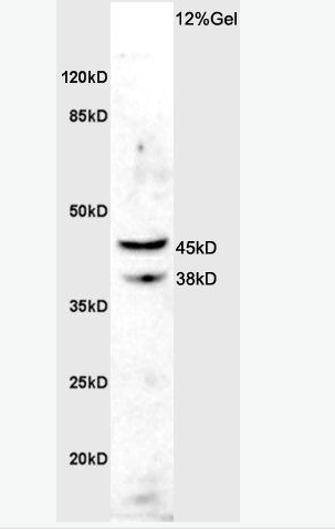 Anti-ASMTY antibody-松果体N甲基乙酰羟色胺抗体