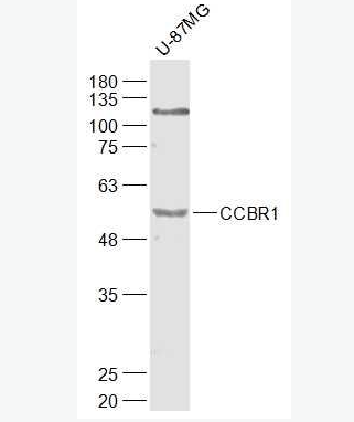 Anti-CCBR1 antibody-钙离子通道阻端耐药蛋白CCBR1抗体