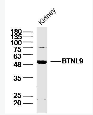 Anti-BTNL9 antibody-嗜乳脂蛋白样9抗体