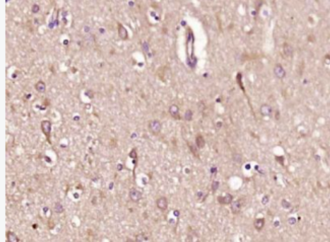 Anti-SCGB3A1 antibody-结合珠蛋白家族3A1抗体