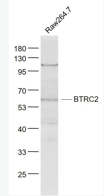 Anti-BTRC2 antibody-BTRC2蛋白抗体