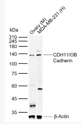 Anti-CDH11/OB Cadherin antibody-钙粘附蛋白-11抗体