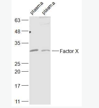 Anti-Factor X antibody-凝血因子10抗体