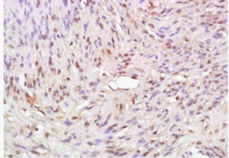 Anti-ATAD2 antibody-三磷酸腺苷酶家族蛋白2抗体