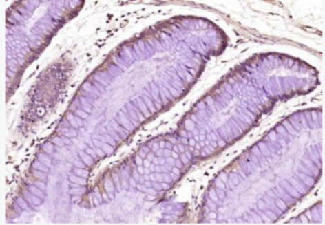 Anti-USP10 antibody-去泛素酶10抗体