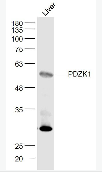 Anti-PDZK1 antibody-PDZ结构域PDZK1蛋白抗体