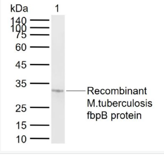 Anti-fbpB antibody-结核分枝杆菌Ag85B/fbpB抗体