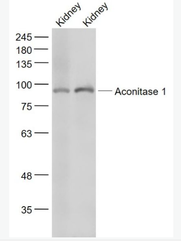 Anti-Aconitase 1 antibody-铁调节蛋白1抗体