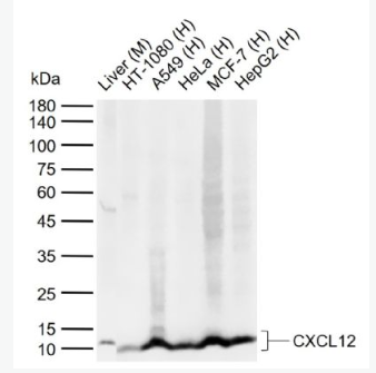 Anti-CXCL12 antibody-基质细胞衍生因子1抗体