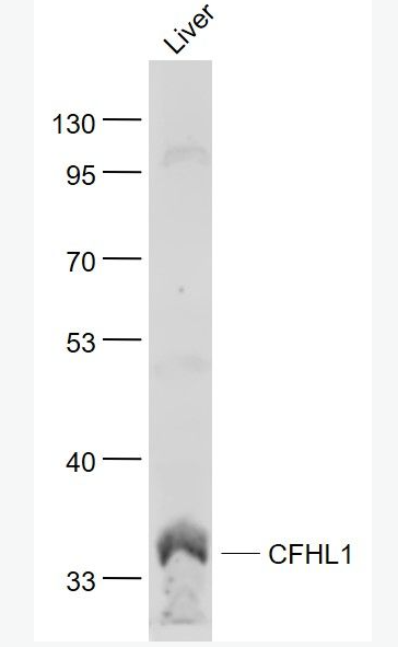 Anti-CFHL1 antibody-补体因子H相关蛋白1抗体