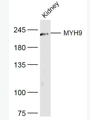 Anti-MYH9 antibody-肌球蛋白重链9抗体