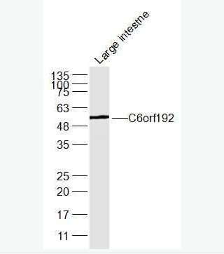 Anti-C6orf192 antibody-8号染色体开放阅读框192抗体