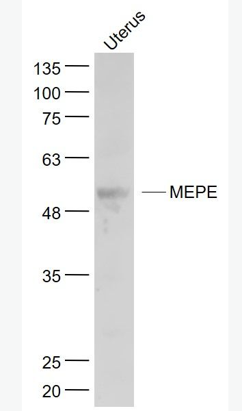 Anti-MEPE antibody-细胞外基质磷酸化抗体