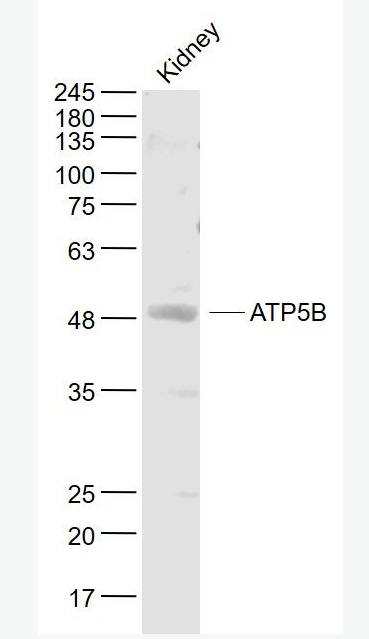 Anti-ATP5B antibody-ATP合成酶β5抗体