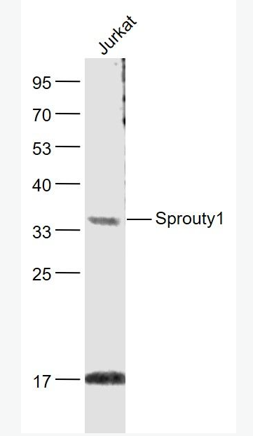 Anti-Sprouty1 antibody-软脂酰化磷蛋白Sprouty1抗体