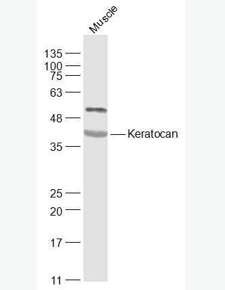 Anti-Keratocan antibody-细胞角膜蛋白多糖抗体