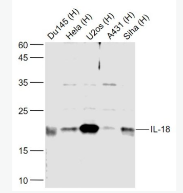 Anti-IL-18 antibody-白细胞介素18抗体