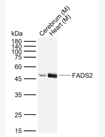 Anti-FADS2antibody-脂肪酸脱氢酶2抗体