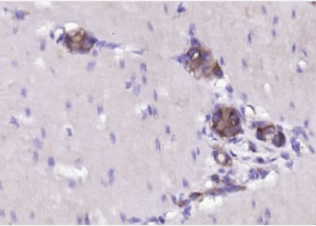 Anti-DUSP6 antibody-双特异性蛋白磷酸酶6/丝裂原活化蛋白激酶磷酸酶3抗体