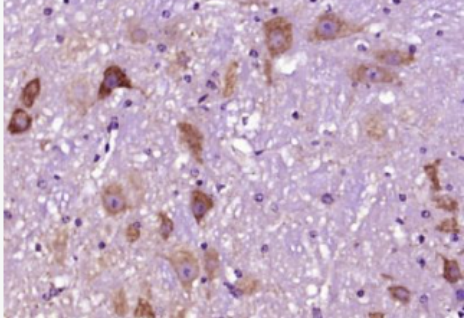 Anti-Syntaxin 13  antibody-神经突触素13抗体