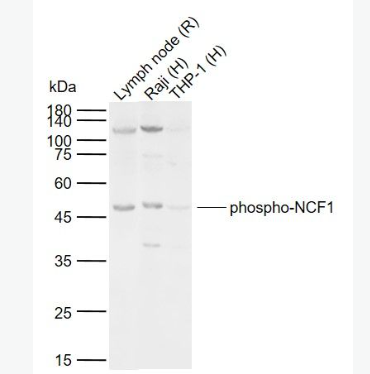 Anti-phospho-NCF1 (Ser359) antibody-磷酸化嗜中性粒细胞胞浆因子1抗体