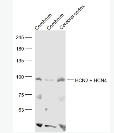 Anti-HCN2 + HCN4 antibody-环化核苷酸调控阳离子通道蛋白亚型2/4抗体