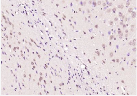 Anti-MAGI1 antibody-膜相关鸟苷酸反转激酶1抗体