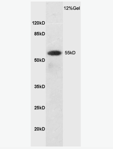 Anti-SLC7A5 antibody-CD98轻链抗体