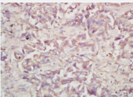 Anti-ATP6V0A1 antibody-氢离子转运ATP合成酶A1抗体