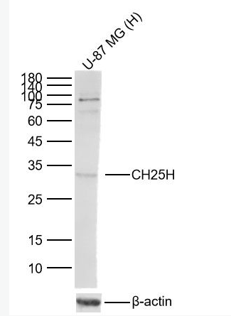 Anti-CH25H antibody-胆固醇25羟化酶抗体