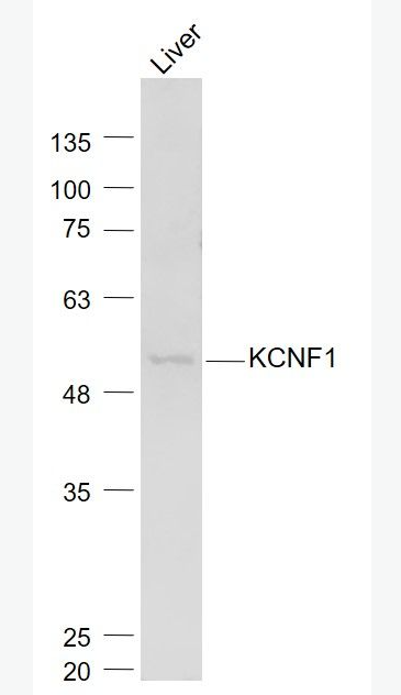 Anti-KCNF1 antibody-电压门控性钾通道蛋白亚基kv5.1抗体