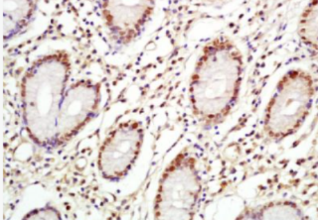 Anti-C-Myc antibody-致癌基因C-Myc抗体