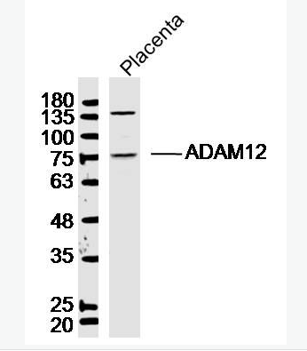 Anti-ADAM12 antibody-去整合素样金属蛋白酶12