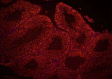 Anti-DAZL antibody-生殖细胞发育相关蛋白DAZL抗体