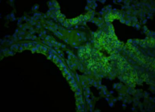 Anti-CTRP5 antibody-补体C1q和肿瘤坏死因子相关蛋白5抗体