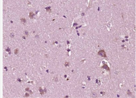 Anti-CHI3L2 antibody-软骨细胞蛋白39抗体