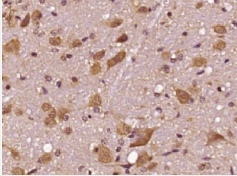 Anti-CPA3 antibody-肥大细胞羧肽酶A3抗体