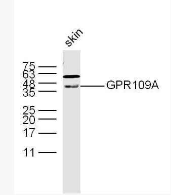 Anti-GPR109A antibody-G蛋白偶联受体109A抗体