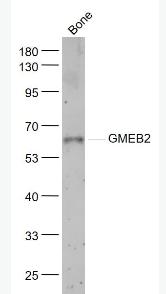 Anti-GMEB2 antibody-糖皮质激素调节元件结合蛋白2抗体