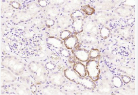 Anti-ART1 antibody-肿瘤抑制相关蛋白PHEMX抗体