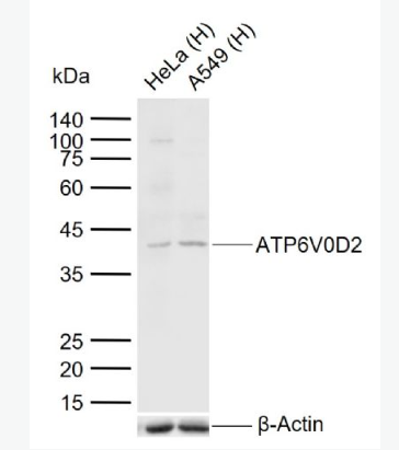 Anti-ATP6V0D2 antibody-ATP6V0D2蛋白抗体