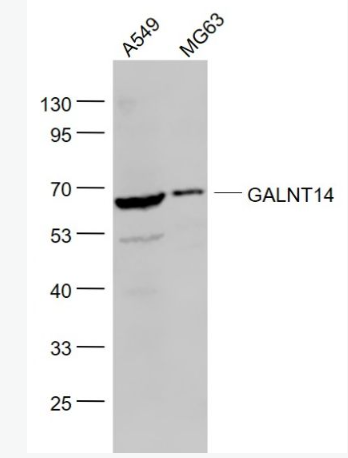 Anti-GALNT14 antibody-GalNAc-T14抗体