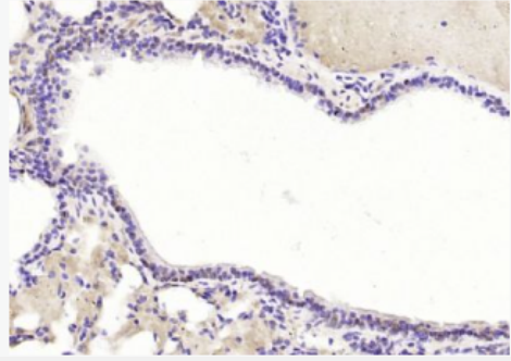 Anti-TRAF6BP antibody-肿瘤坏死因子受体相关蛋白6结合蛋白抗体