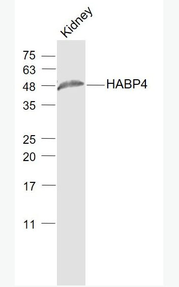 Anti-HABP4 antibody-透明质酸结合蛋白4抗体