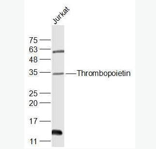 Anti-Thrombopoietin antibody-血小板生成素/巨核细胞集落刺激因子抗体