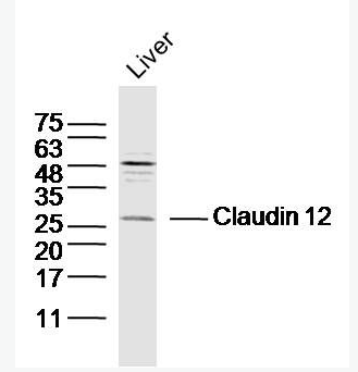 Anti-Claudin 12 antibody-紧密连接蛋白12抗体