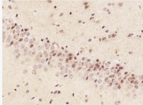 Anti-phospho-alpha B Crystallin (Ser59) antibody-磷酸化热休克蛋白β5/αb晶体蛋白质/α-晶体蛋白b链抗体